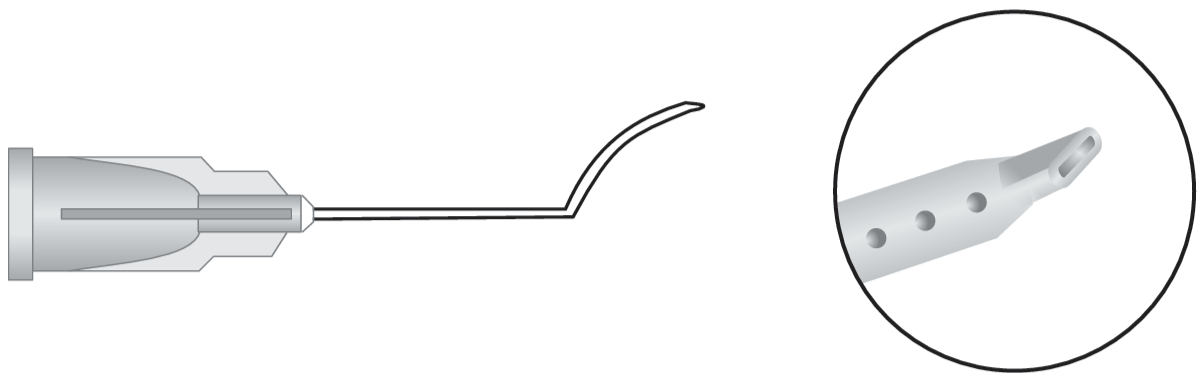 Lasik Irrigating Cannula (Assis)